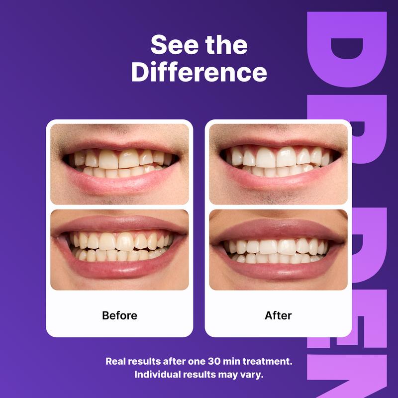 Dentley™ Purple Whitening Strips