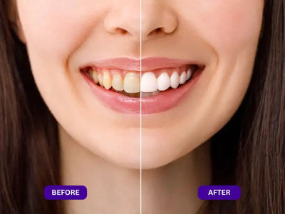 DR DENT™ Purple Whitening Strips Angle 4