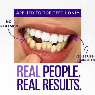 DR DENT™ Purple Whitening Strips Angle 3