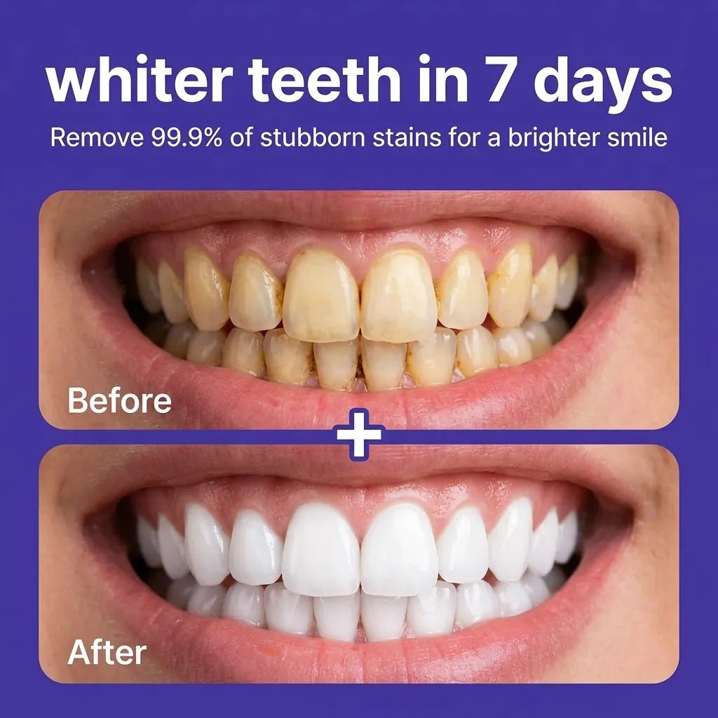 Lunira Whitening Strips