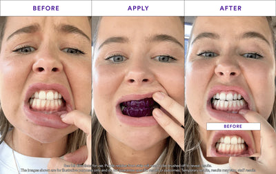 Dentley™ Purple Whitening Strips