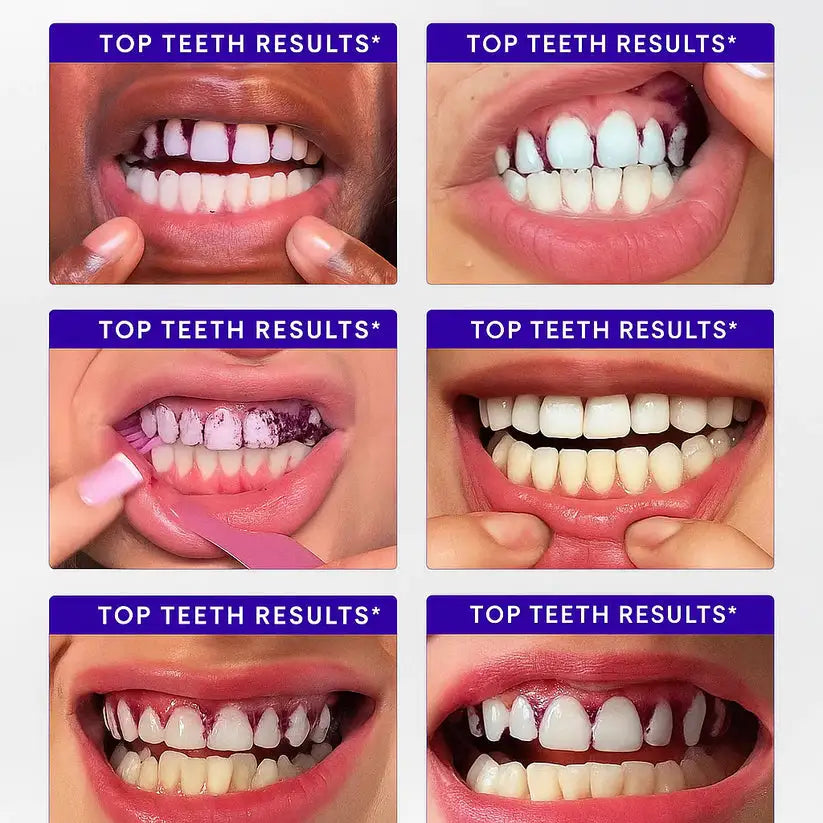 DR DENT™ Purple Whitening Strips Angle 3