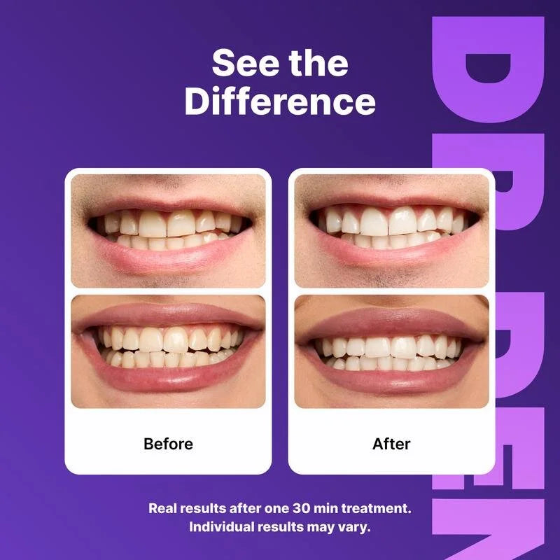 DR DENT™ Purple Whitening Strips Angle 3